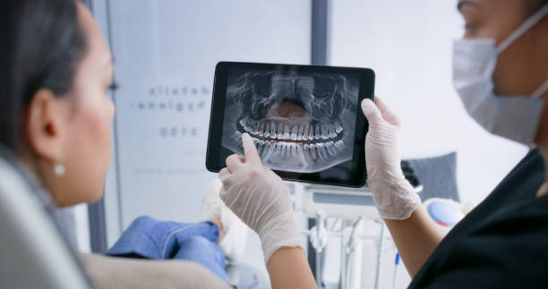 Licensed Wisdom Tooth Removal service in Morristown, NJ - Dentist Open Now